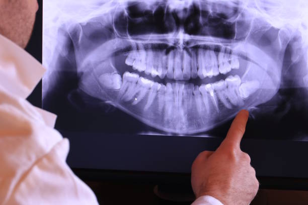 Best Chipped Tooth Repair Near Me  in Rahway, NJ