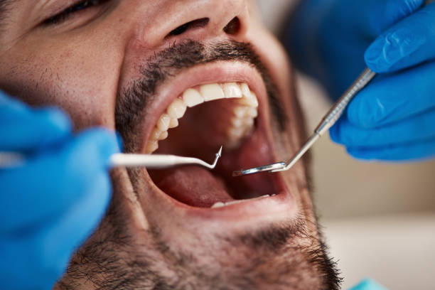 Best Cracked Tooth Emergency Dentist  in Rahway, NJ